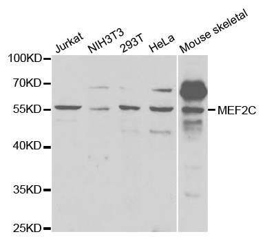 MEF2C Antibody - Western blot analysis of extracts of various cell lines, using MEF2C antibody.