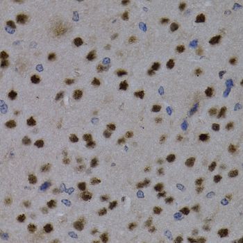 MEF2C Antibody - Immunohistochemistry of paraffin-embedded mouse brain tissue.