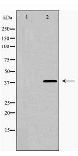 MEF2C Antibody - Western blot of LEG9 expression in HepG2 cells