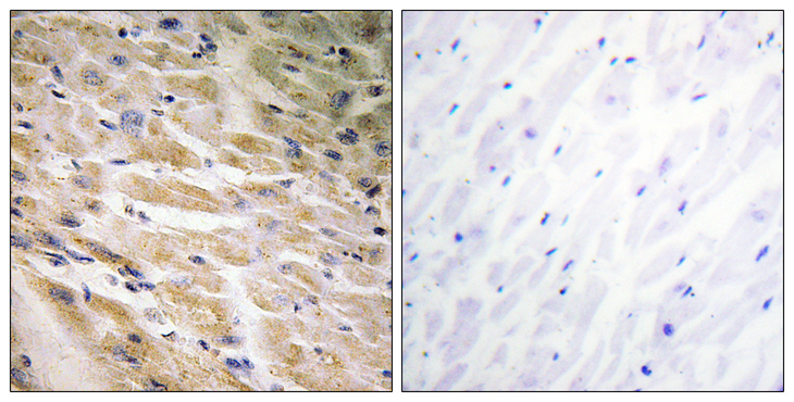 MEF2C Antibody - Immunohistochemistry analysis of paraffin-embedded human heart, using MEF2C (Phospho-Ser387) Antibody. The picture on the right is blocked with the phospho peptide.