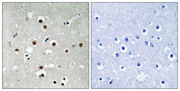 MEF2C Antibody - Immunohistochemistry analysis of paraffin-embedded human brain, using MEF2C (Phospho-Ser396) Antibody. The picture on the right is blocked with the phospho peptide.