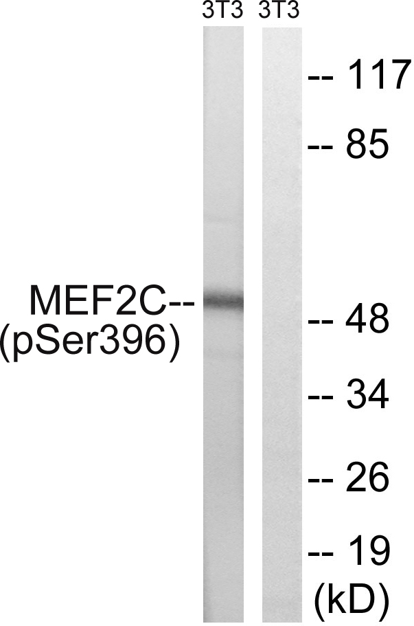 MEF2C Antibody - Western blot analysis of lysates from NIH/3T3 cells treated with starved 24h, using MEF2C (Phospho-Ser396) Antibody. The lane on the right is blocked with the phospho peptide.