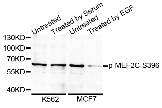 MEF2C Antibody - Western blot analysis of extracts of various cell lines.