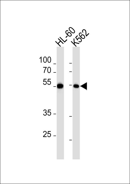 MEF2C Antibody - MEF2C Antibody (pS387) western blot of HL-60,K562 cell line lysates (35 ug/lane). The MEF2C antibody detected the MEF2C protein (arrow).