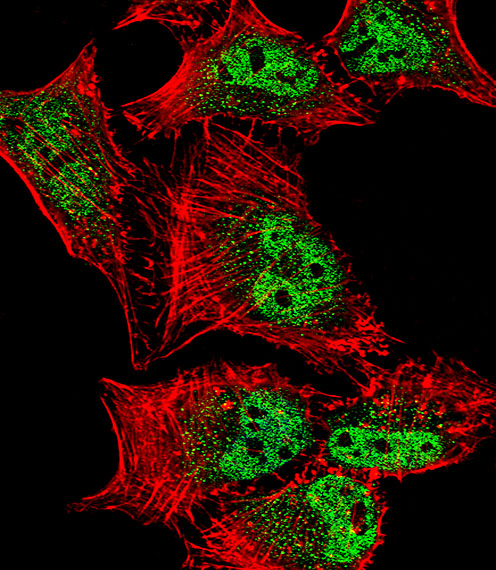 MEF2C Antibody - Fluorescent confocal image of HeLa cell stained with MEF2C Antibody (S387). HeLa cells were fixed with 4% PFA (20 min), permeabilized with Triton X-100 (0.1%, 10 min), then incubated with MEF2C primary antibody (1:25, 1 h at 37°C). For secondary antibody, Alexa Fluor 488 conjugated donkey anti-rabbit antibody (green) was used (1:400, 50 min at 37°C). Cytoplasmic actin was counterstained with Alexa Fluor 555 (red) conjugated Phalloidin (7units/ml, 1 h at 37°C). Nuclei were counterstained with DAPI (blue) (10 ug/ml, 10 min). MEF2C immunoreactivity is localized to vesicles and Nucleus significantly.