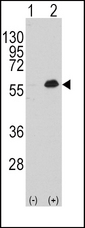 MEF2C Antibody - Western blot of MEF2C (arrow) using rabbit polyclonal MEF2C Antibody (T300) (RB11009). 293 cell lysates (2 ug/lane) either nontransfected (Lane 1) or transiently transfected with the MEF2C gene (Lane 2) (Origene Technologies).