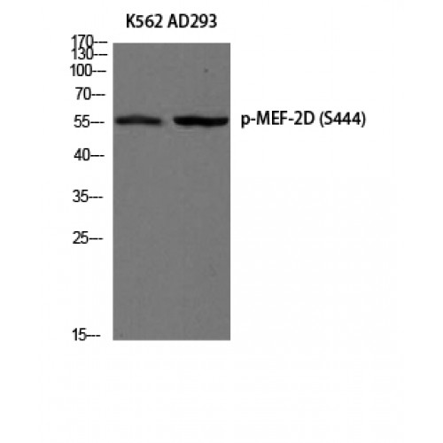 MEF2D Antibody - Western blot of Phospho-MEF-2D (S444) antibody
