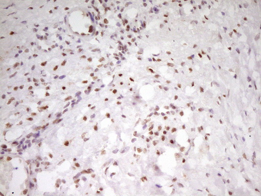 MEF2D Antibody - Immunohistochemical staining of paraffin-embedded Human Ovary tissue within the normal limits using anti-MEF2D mouse monoclonal antibody. (Heat-induced epitope retrieval by 1 mM EDTA in 10mM Tris, pH8.5, 120C for 3min,