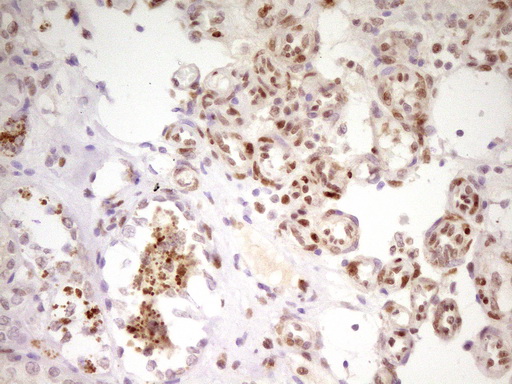 MEF2D Antibody - Immunohistochemical staining of paraffin-embedded Human Kidney tissue within the normal limits using anti-MEF2D mouse monoclonal antibody. (Heat-induced epitope retrieval by 1 mM EDTA in 10mM Tris, pH8.5, 120C for 3min,