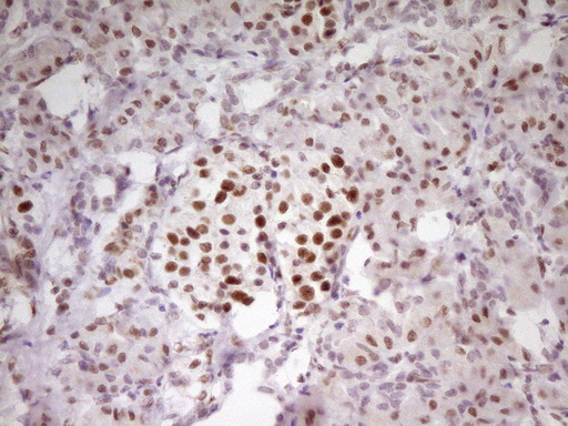 MEF2D Antibody - IHC of paraffin-embedded Human pancreas tissue using anti-MEF2D mouse monoclonal antibody. (Heat-induced epitope retrieval by 1 mM EDTA in 10mM Tris, pH8.5, 120°C for 3min).