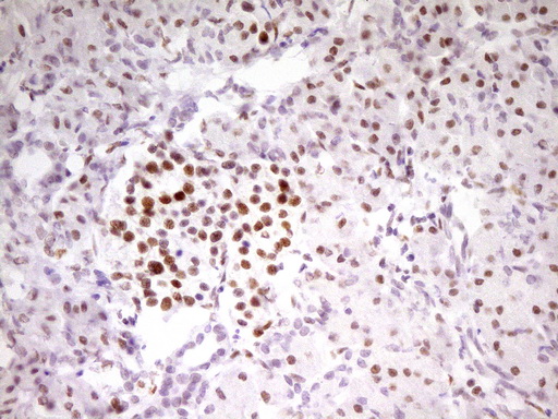 MEF2D Antibody - Immunohistochemical staining of paraffin-embedded Human pancreas tissue within the normal limits using anti-MEF2D mouse monoclonal antibody. (Heat-induced epitope retrieval by 1 mM EDTA in 10mM Tris, pH8.5, 120C for 3min,