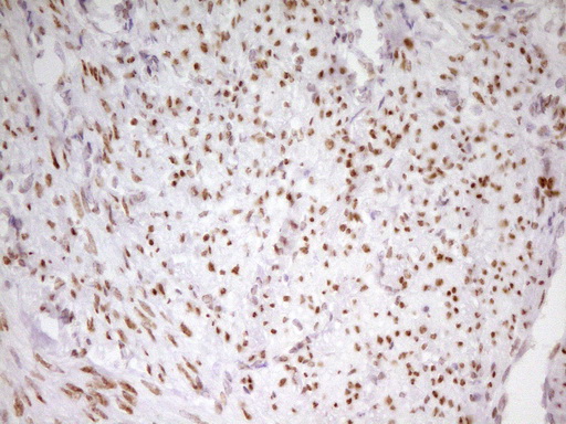 MEF2D Antibody - Immunohistochemical staining of paraffin-embedded Human endometrium tissue within the normal limits using anti-MEF2D mouse monoclonal antibody. (Heat-induced epitope retrieval by 1 mM EDTA in 10mM Tris, pH8.5, 120C for 3min,