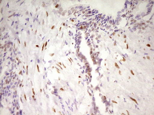 MEF2D Antibody - Immunohistochemical staining of paraffin-embedded Human prostate tissue within the normal limits using anti-MEF2D mouse monoclonal antibody. (Heat-induced epitope retrieval by 1 mM EDTA in 10mM Tris, pH8.5, 120C for 3min,
