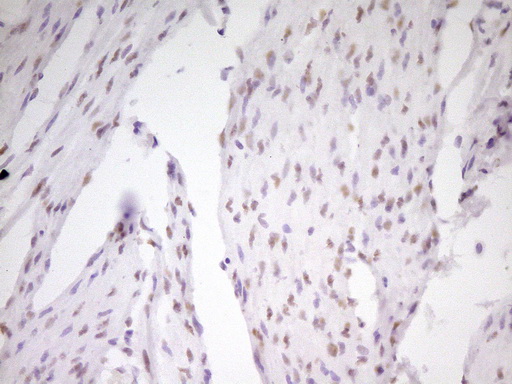MEF2D Antibody - Immunohistochemical staining of paraffin-embedded Human bladder tissue within the normal limits using anti-MEF2D mouse monoclonal antibody. (Heat-induced epitope retrieval by 1 mM EDTA in 10mM Tris, pH8.5, 120C for 3min,