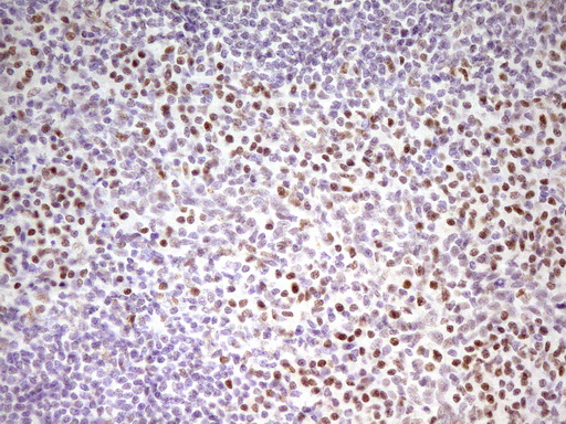 MEF2D Antibody - Immunohistochemical staining of paraffin-embedded Human tonsil within the normal limits using anti-MEF2D mouse monoclonal antibody. (Heat-induced epitope retrieval by 1 mM EDTA in 10mM Tris, pH8.5, 120C for 3min,