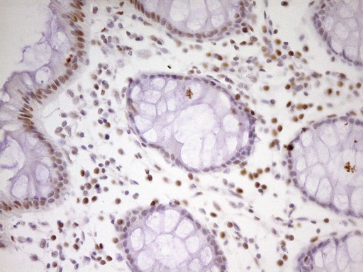 MEF2D Antibody - Immunohistochemical staining of paraffin-embedded Human colon tissue within the normal limits using anti-MEF2D mouse monoclonal antibody. (Heat-induced epitope retrieval by 1 mM EDTA in 10mM Tris, pH8.5, 120C for 3min,