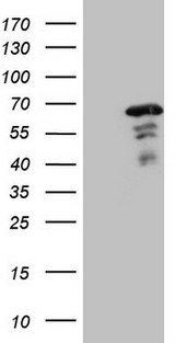 MEF2D Antibody - HEK293T cells were transfected with the pCMV6-ENTRY control (Left lane) or pCMV6-ENTRY MEF2D (Right lane) cDNA for 48 hrs and lysed. Equivalent amounts of cell lysates (5 ug per lane) were separated by SDS-PAGE and immunoblotted with anti-MEF2D.