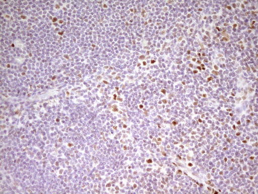 MEF2D Antibody - IHC of paraffin-embedded Human lymph node tissue using anti-MEF2D mouse monoclonal antibody. (Heat-induced epitope retrieval by 1 mM EDTA in 10mM Tris, pH8.5, 120°C for 3min).