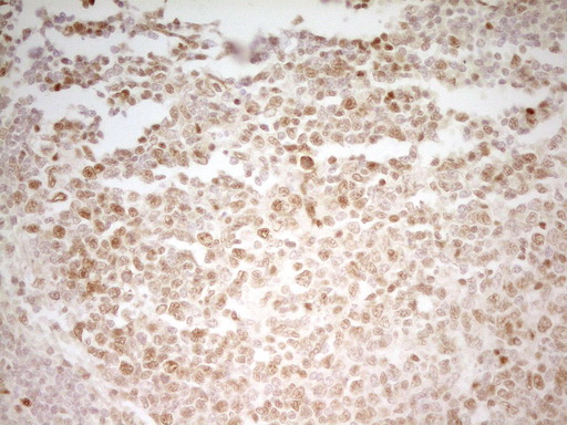 MEF2D Antibody - Immunohistochemical staining of paraffin-embedded Human tonsil within the normal limits using anti-MEF2D mouse monoclonal antibody. (Heat-induced epitope retrieval by 1 mM EDTA in 10mM Tris, pH8.5, 120C for 3min,