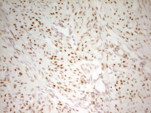 MEF2D Antibody - IHC of paraffin-embedded Human endometrium tissue using anti-MEF2D mouse monoclonal antibody. (Heat-induced epitope retrieval by 1 mM EDTA in 10mM Tris, pH8.5, 120°C for 3min).