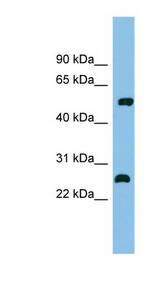 MEF2D Antibody - MEF2D antibody Western blot of Fetal Kidney lysate. This image was taken for the unconjugated form of this product. Other forms have not been tested.