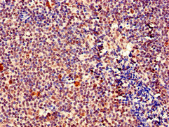 MEF2D Antibody - Immunohistochemistry of paraffin-embedded human tonsil tissue using MEF2D Antibody at dilution of 1:100