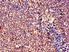 MEF2D Antibody - Immunohistochemistry of paraffin-embedded human tonsil tissue using MEF2D Antibody at dilution of 1:100