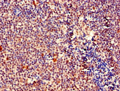 MEF2D Antibody - IHC image of MEF2D Antibody diluted at 1:400 and staining in paraffin-embedded human tonsil tissue performed on a Leica BondTM system. After dewaxing and hydration, antigen retrieval was mediated by high pressure in a citrate buffer (pH 6.0). Section was blocked with 10% normal goat serum 30min at RT. Then primary antibody (1% BSA) was incubated at 4°C overnight. The primary is detected by a biotinylated secondary antibody and visualized using an HRP conjugated SP system.