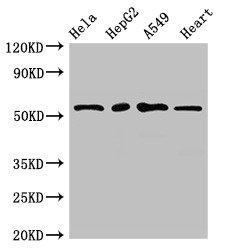 MEF2D Antibody - Western Blot Positive WB detected in: Hela whole cell lysate, HepG2 whole cell lysate, A549 whole cell lysate, Mouse heart tissue All lanes: MEF2D antibody at 2.7µg/ml Secondary Goat polyclonal to rabbit IgG at 1/50000 dilution Predicted band size: 56, 57, 51, 50 kDa Observed band size: 56 kDa