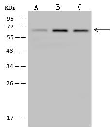 MEF2D Antibody - Anti-MEF2D rabbit polyclonal antibody at 1:500 dilution. Lane A: HeLa Whole Cell Lysate. Lane B: Jurkat Whole Cell Lysate. Lane C: U-251 MG Whole Cell Lysate. Lysates/proteins at 30 ug per lane. Secondary: Goat Anti-Rabbit IgG (H+L)/HRP at 1/10000 dilution. Developed using the ECL technique. Performed under reducing conditions. Predicted band size: 56 kDa. Observed band size: 65 kDa.