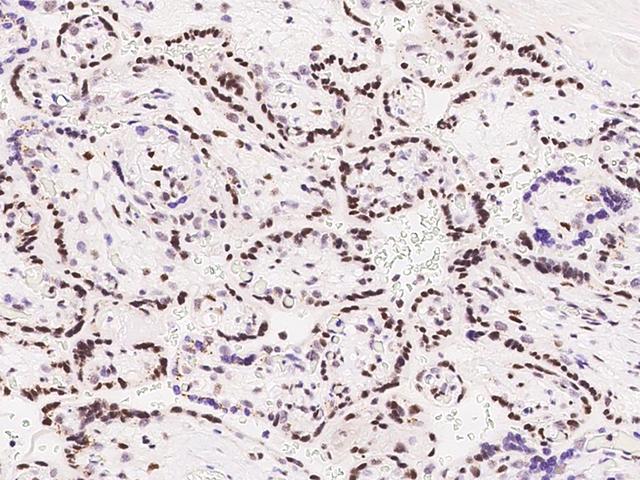 MEF2D Antibody - Immunochemical staining of human MEF2D in human placenta with rabbit polyclonal antibody at 1:100 dilution, formalin-fixed paraffin embedded sections.