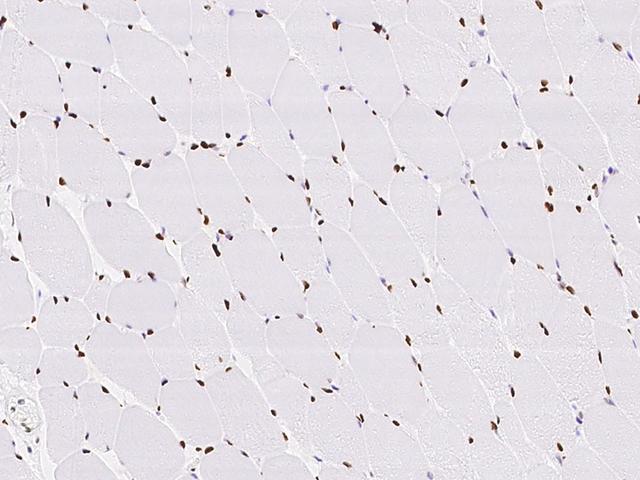MEF2D Antibody - Immunochemical staining of human MEF2D in human skeletal muscle with rabbit polyclonal antibody at 1:100 dilution, formalin-fixed paraffin embedded sections.