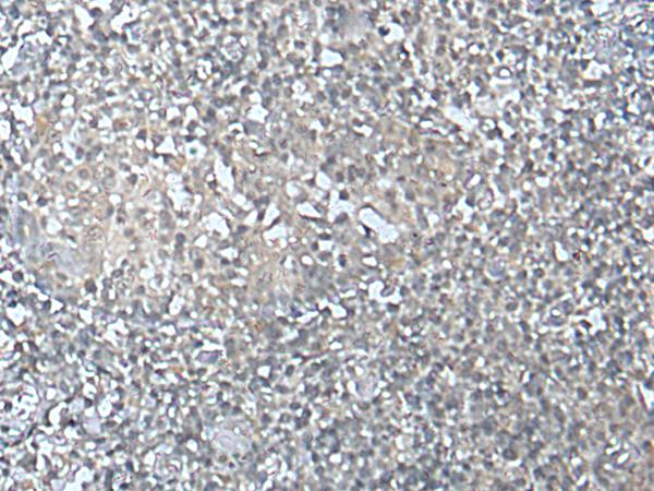 MEF2D Antibody - Immunohistochemistry of paraffin-embedded Human tonsil tissue  using MEF2D Polyclonal Antibody at dilution of 1:50(×200)