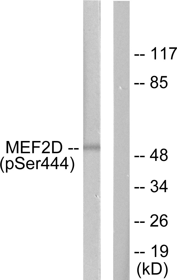 MEF2D Antibody - Western blot analysis of lysates from HepG2 cells treated with forskolin 40nM 30', using MEF2D (Phospho-Ser444) Antibody. The lane on the right is blocked with the phospho peptide.