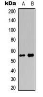 MEF2D Antibody - Western blot analysis of MEF2D (pS444) expression in K562 (A); HepG2 (B) whole cell lysates.