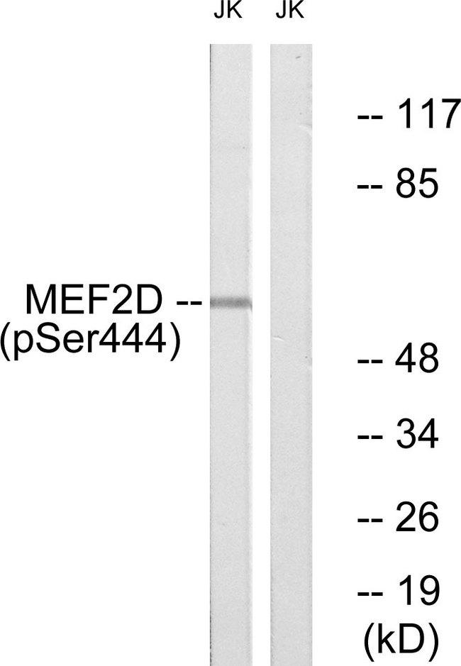 MEF2D Antibody - Western blot analysis of extracts from HepG2 cells, treated with forskolin (40nM, 30mins), using MEF2D (Phospho-Ser444) antibody.