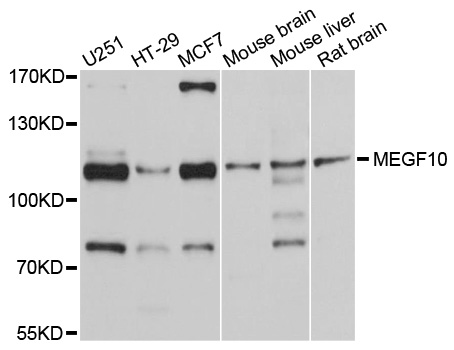 MEGF10 Antibody - Western blot analysis of extracts of various cell lines, using MEGF10 antibody at 1:1000 dilution. The secondary antibody used was an HRP Goat Anti-Rabbit IgG (H+L) at 1:10000 dilution. Lysates were loaded 25ug per lane and 3% nonfat dry milk in TBST was used for blocking. An ECL Kit was used for detection and the exposure time was 10s.