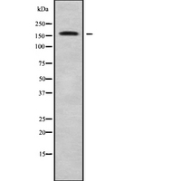 MEGF6 Antibody - Western blot analysis of MEGF6 using Jurkat whole cells lysates