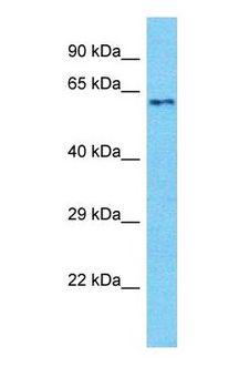 MEGF9 / EGFL5 Antibody - Western blot of MEGF9 Antibody with RPMI-8226 Whole Cell lysate.  This image was taken for the unconjugated form of this product. Other forms have not been tested.