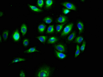 MEGF9 / EGFL5 Antibody - Immunofluorescence staining of A549 cells at a dilution of 1:100, counter-stained with DAPI. The cells were fixed in 4% formaldehyde, permeabilized using 0.2% Triton X-100 and blocked in 10% normal Goat Serum. The cells were then incubated with the antibody overnight at 4 °C.The secondary antibody was Alexa Fluor 488-congugated AffiniPure Goat Anti-Rabbit IgG (H+L) .