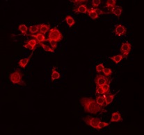 MEGF9 / EGFL5 Antibody - Staining COLO205 cells by IF/ICC. The samples were fixed with PFA and permeabilized in 0.1% Triton X-100, then blocked in 10% serum for 45 min at 25°C. The primary antibody was diluted at 1:200 and incubated with the sample for 1 hour at 37°C. An Alexa Fluor 594 conjugated goat anti-rabbit IgG (H+L) Ab, diluted at 1/600, was used as the secondary antibody.