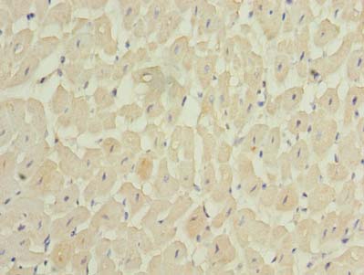 MEI1 Antibody - Immunohistochemistry of paraffin-embedded human heart tissue using antibody at dilution of 1:100.