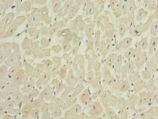 MEI1 Antibody - Immunohistochemistry of paraffin-embedded human heart tissue using antibody at dilution of 1:100.