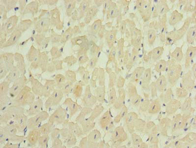MEI1 Antibody - Immunohistochemistry of paraffin-embedded human heart tissue using MEI1 Antibody at dilution of 1:100