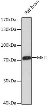 MEI1 Antibody - Western blot analysis of extracts of rat brain using MEI1 Polyclonal Antibody at dilution of 1:1000.