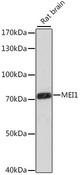 MEI1 Antibody - Western blot analysis of extracts of rat brain using MEI1 Polyclonal Antibody at dilution of 1:1000.