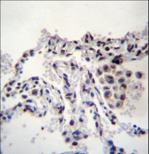 MEIG1 Antibody - MEIG1 Antibody immunohistochemistry of formalin-fixed and paraffin-embedded human lung tissue followed by peroxidase-conjugated secondary antibody and DAB staining.
