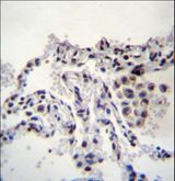 MEIG1 Antibody - MEIG1 Antibody immunohistochemistry of formalin-fixed and paraffin-embedded human lung tissue followed by peroxidase-conjugated secondary antibody and DAB staining.