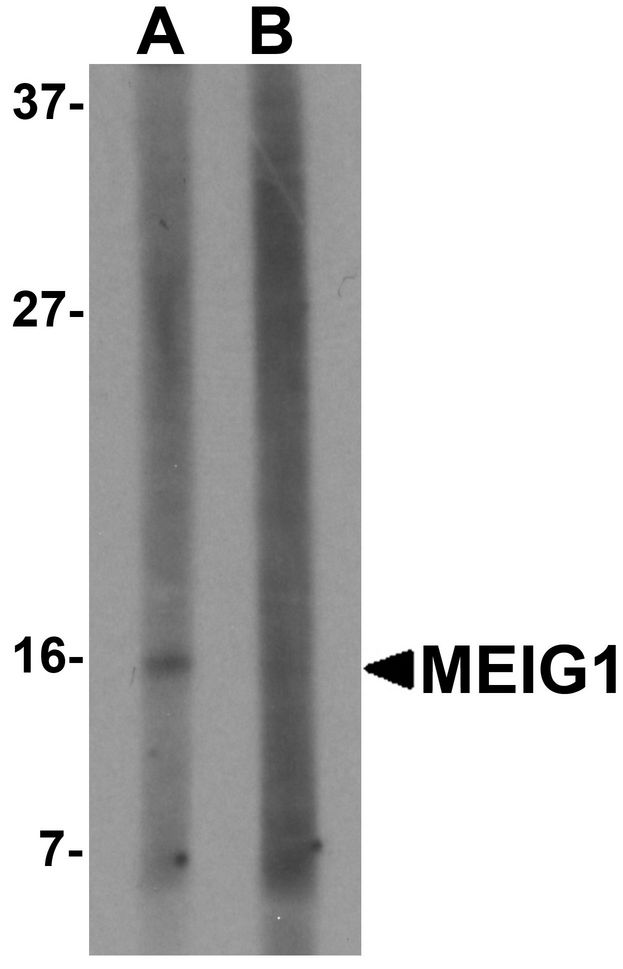 MEIG1 Antibody - Western blot analysis of MEIG in K562 cell lysate with MEIG antibody at 1 ug/ml in (A) the absence and (B) the presence of blocking peptide.