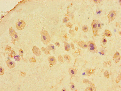 MEIKIN Antibody - Immunohistochemistry of paraffin-embedded human placental tissue using MEIKIN Antibody at dilution of 1:100